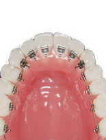 �����Ȃ�����